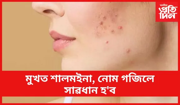 এইসমূহ উপেক্ষা কৰিলে আপুনি ভূগিব লাগিব গুৰুতৰ স্বাস্থ্য সমস্যাত
